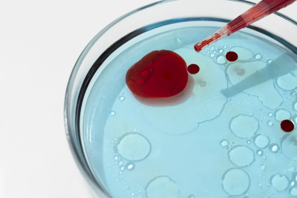 Haemophilia B